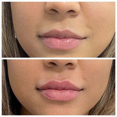 Lips by Nurse Nada