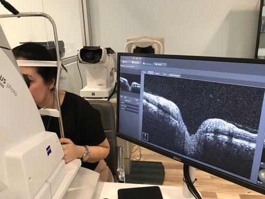 Ocular coherence tomography like an MRI of the eye. Checks for Glaucoma, macular degeneration and much more