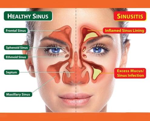 Los Angeles Best Sinus Doctor