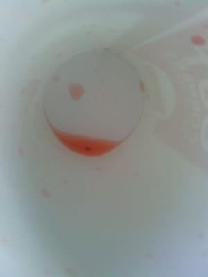 Bug that was in the bottom of my drink