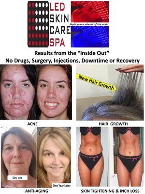 Come "Glow" with us.  Acne, Aging, Balding, Weight Loss.