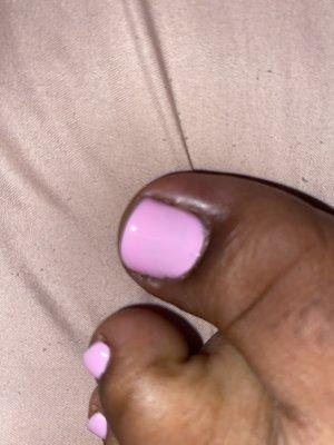 A very cute but infected toe