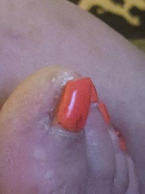 1 week after!  $108.00 +$10.00 sympathy tip.  Painful hangnail!  It's red & swollen! Can't believe owner hasn't tried to make it right!