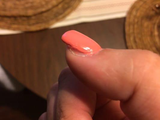 My "repaired" thumb nail.