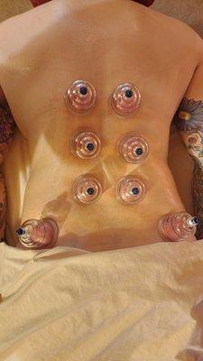 Now offering cupping massage!