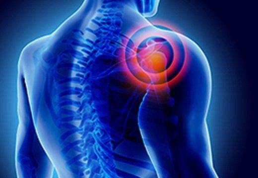 shoulder pain relief in Orlando