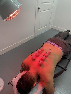 Cupping and infrared heat helps expedite the healing process and promotes circulation