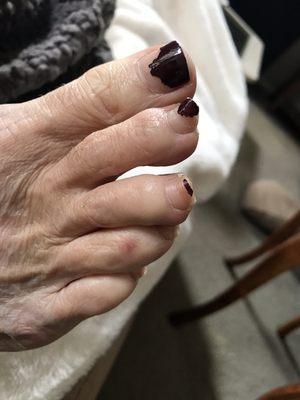 Six weeks after pedi.  I know my toes need help but scared to get another pedi!!