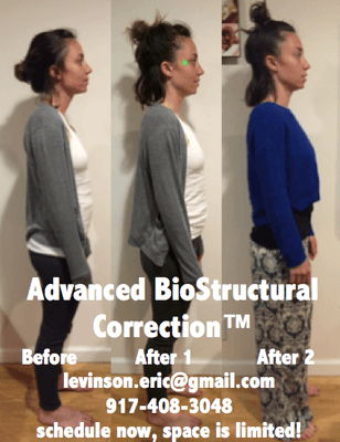 Advanced BioStructural Correction™ is a proven system that can eliminate back pain, headaches, and other symptoms of poor posture.