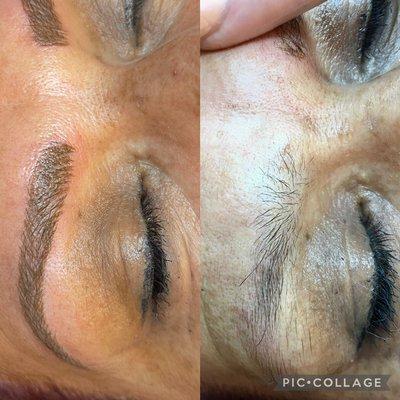 Microblading