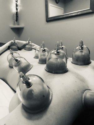 Come in for a cupping session with our training massage therapists.  Find out about the many benefits of cupping and how it can help you.