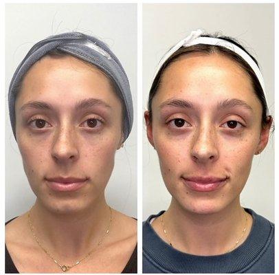 Facial Balancing & Harmonization