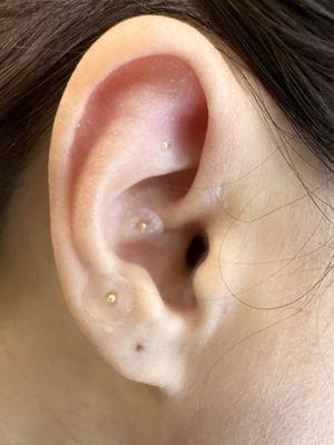 Ear seeding