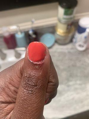 Regal nails finger damage