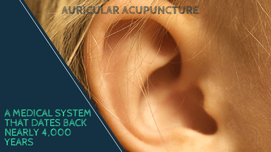 Auricular  Therapy