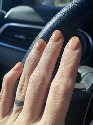 Cellulite-lumpy manicure that won't last a week