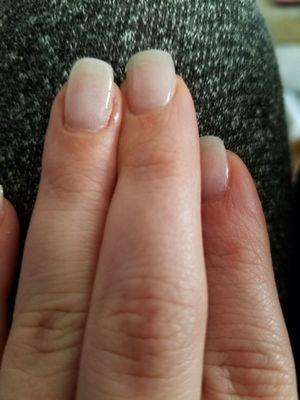 Ring finger left nail rugged and painful