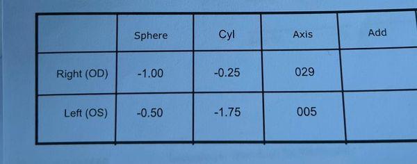 SVS eye results.