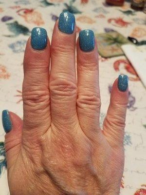 Latest gel fill! Sharon rocks!