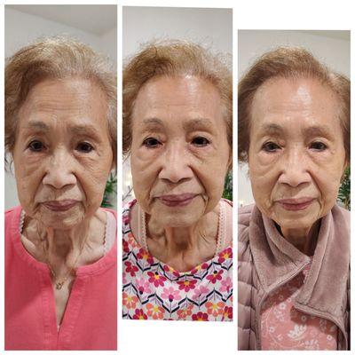 10 sessions of facial treatments( including facial acupuncture)