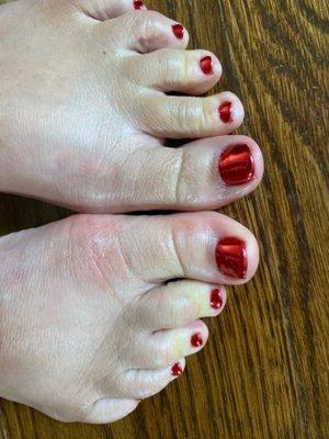 My pedicure