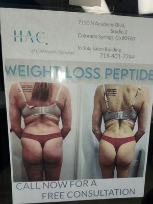 Actual patient's weight loss results with our medical weight loss program. This result was in 3 months.