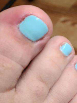 2nd "free pedi" my big toe is swollen and red and sore to touch. Painted partially