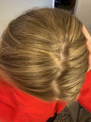 Huge line on my head from foils bleeding