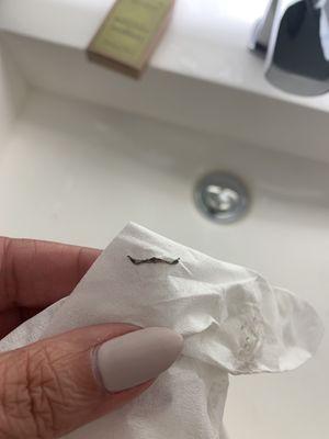 Pieces I pulled out of my eye.