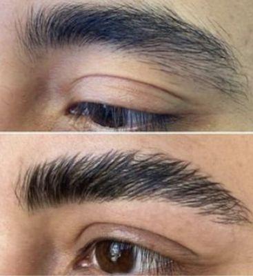 Brow shaping