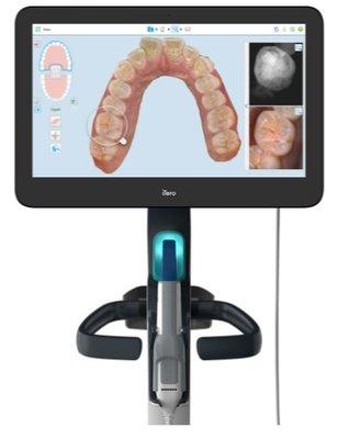 We now offer Itero Scanning at our Port St Lucie Location.