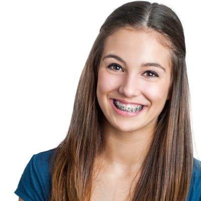 Braces at Summit Orthodontics in Chino, CA