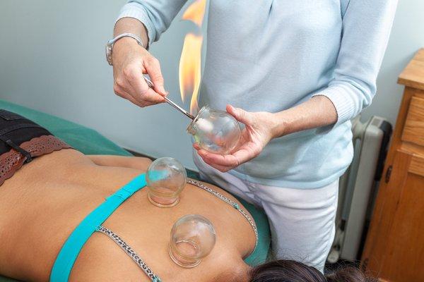 Using cupping for tension and tight muscles