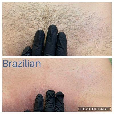 Brazilian Wax