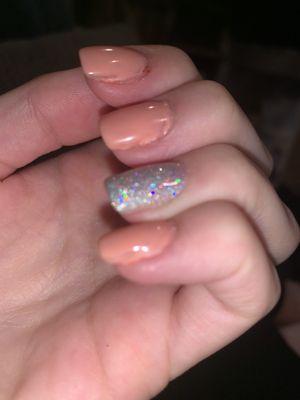 Bare spots throughout the nails