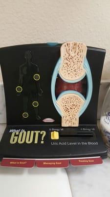 What to know about GOUT...thats not what I'm here for lol but a good view.