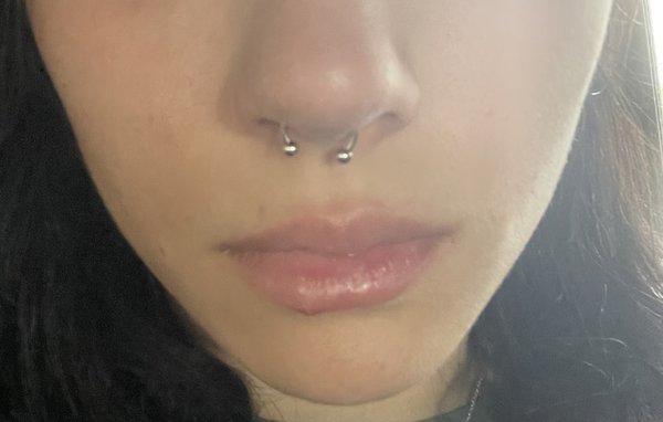 Septum