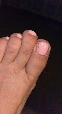 Bad pedicure!