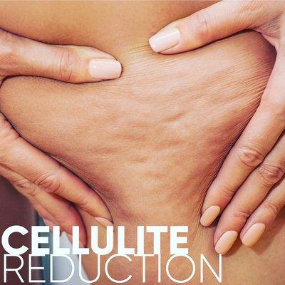 Cellulite reduction