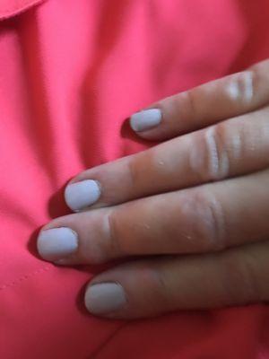 Painted cuticles - technician failed to bring base color to the left and right edges and in 3 days the edges peeled off.