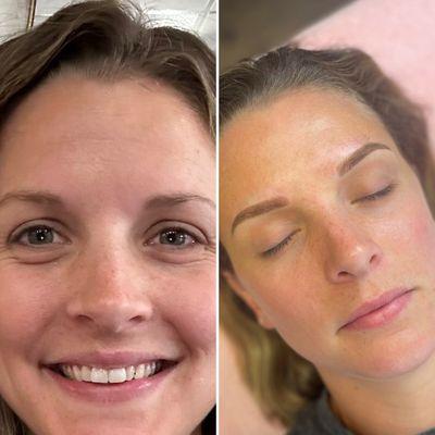 Before and after of a Microblading session.