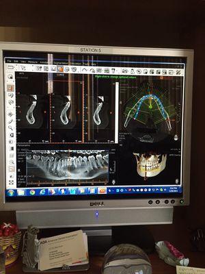 CBCT 3D scans. Our standard of care keeps getting higher and higher