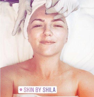 Too Cute! Treat yourself to a Hydrafacial at Skin By Shila. The treatment is soothing, refreshing and immediately effective. @skinbyshila