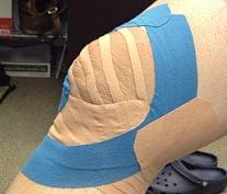 Therapeutic taping...
 Knee rehabilitation