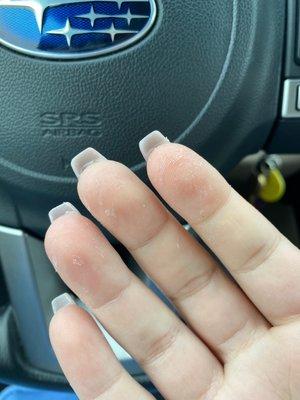 Glue on my fingers after leaving