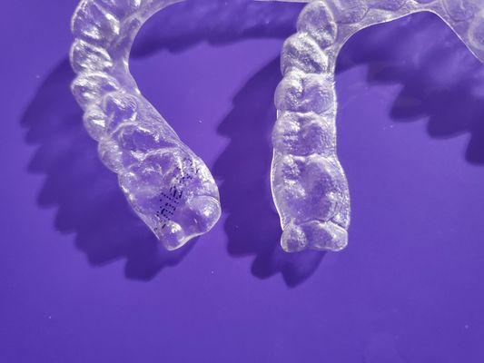 Aligner on the left (#10 out of 11) where the back teeth were all smashed. Aligner on the right for reference of what it should look like.