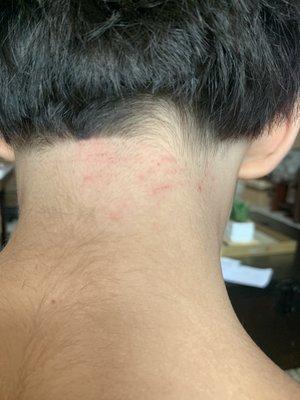 This is how my son came home after a haircut!! He said she was rough!!! Look at all the red marks on his neck!!!