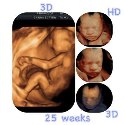 Beautiful 3D image of a Baby at 25 weeks, a full body shot is achieveable and possible when an expecting lady comes in this early.