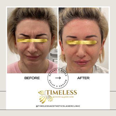 Timeless Aesthetics & Laser Clinic