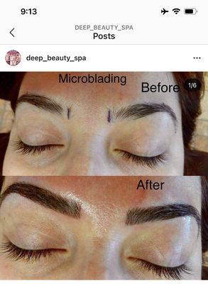 Microblading